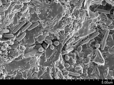 Bacteriophages attacking Escherichia coli.